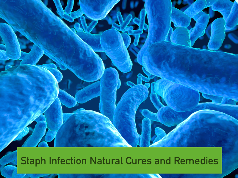 Staph Infection Natural Cures and Remedies